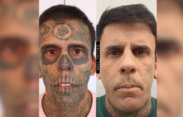 Homem Mais Tatuado do Brasil Faz Exames Para Tratar Tumor na Bexiga